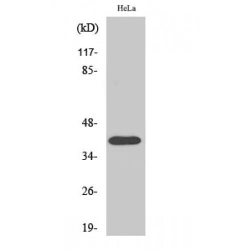 Polyclonal Rabbit anti-Human P2RY8 / P2Y8 Antibody (170-250 aa, Internal, IF, WB)