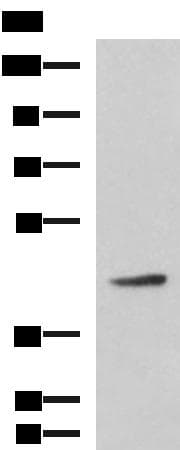 Polyclonal Rabbit anti-Human ARPC1B / p41-ARC / ARP2 Antibody (WB)