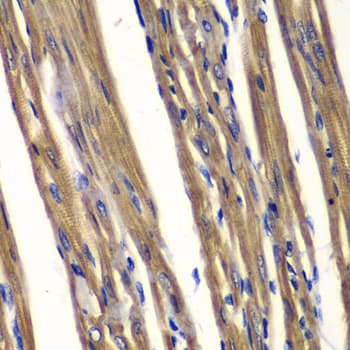 PTPN2 / TC-PTP Antibody