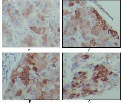 EDR / PEG10 Antibody (clone 4C10A7)
