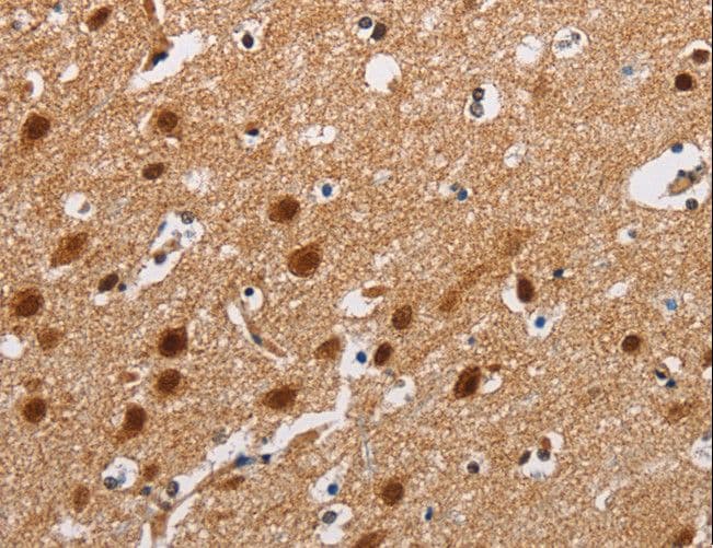Polyclonal Rabbit anti-Human ATXN1 / SCA1 Antibody (IHC)