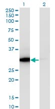 IHC-plus™ ATP6E / ATP6V1E1 Antibody (clone 4E11)