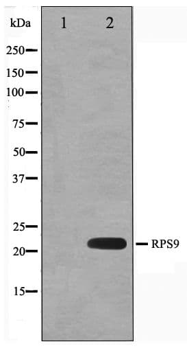 Polyclonal Rabbit anti-Human RPS9 / Ribosomal Protein S9 Antibody (IF, WB)