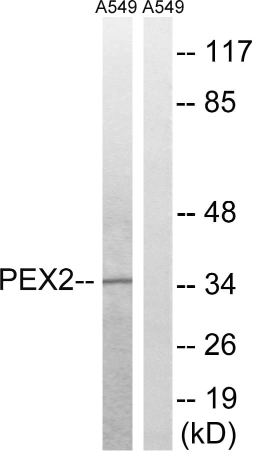 Polyclonal Rabbit anti-Human PEX2 / PAF-1 Antibody (aa1-50, IHC, WB)