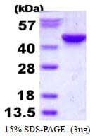 Human ITPK1 Protein (Recombinant His)