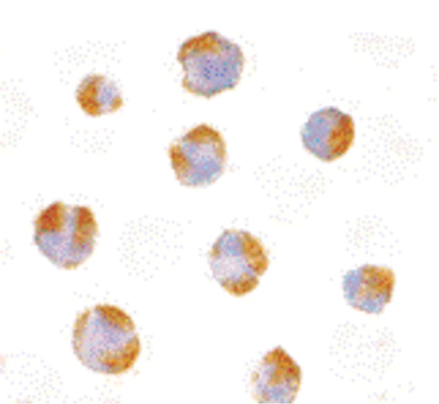 IHC-plus™ Polyclonal Rabbit anti-Human TNFRSF14 / CD270 / HVEM Antibody (IHC, IF, WB)
