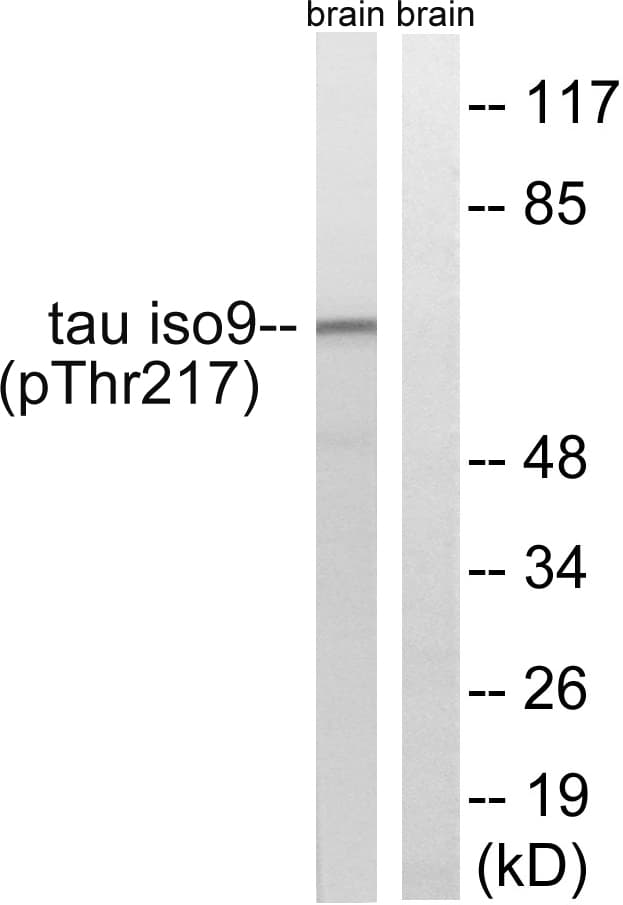 MAPT / Tau Antibody (phospho-Thr534)