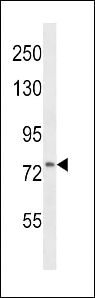 VCAM1 / CD106 Antibody (aa295-322)