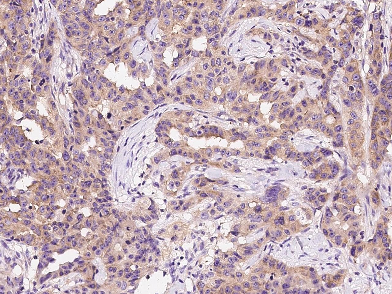 KARS Antibody (Preservative Free)