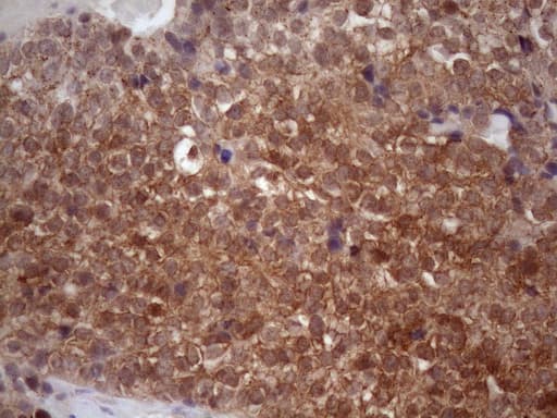 Vps60 / CHMP5 Antibody (clone OTI5F12, Carrier-free)