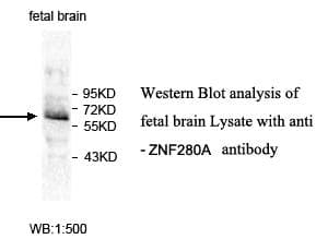 Polyclonal Rabbit anti-Human ZNF280A Antibody (aa270-530, IHC, WB)