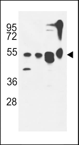 IHC-plus™ KIAA0652 / ATG13 Antibody (aa1-30)
