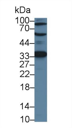 ACD / PTOP Antibody (aa21-175, Cy3)