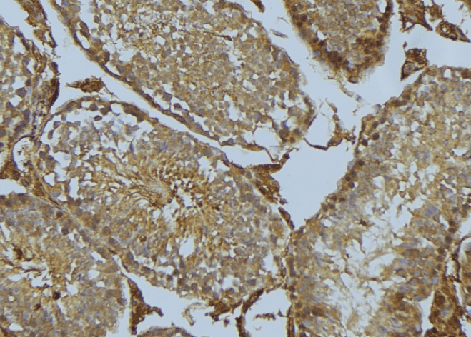 CYB5R3 / B5R Antibody