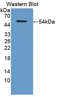 COL5A2 / Collagen V Alpha 2 Antibody (aa82-308)