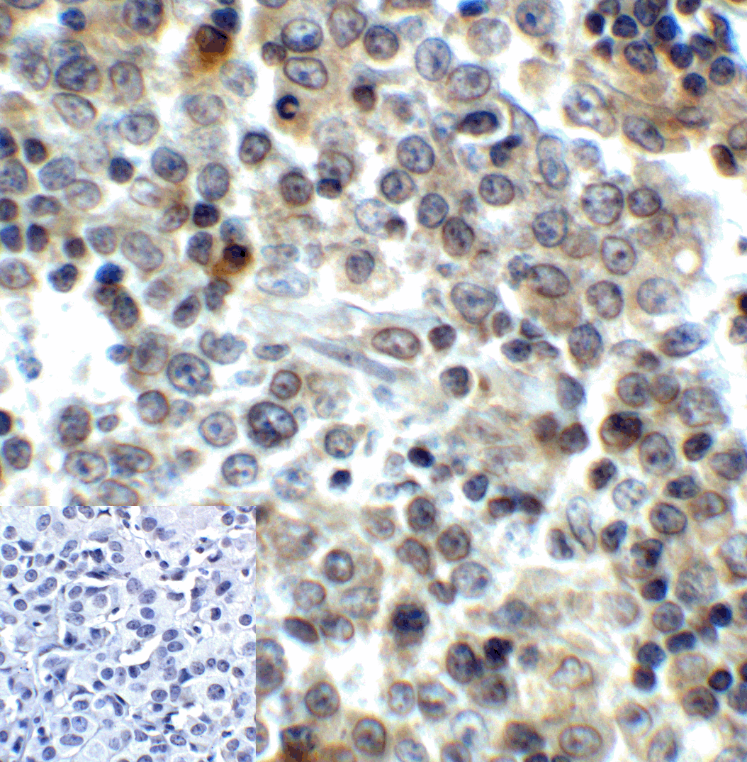 Monoclonal Mouse anti-Human LAG3 Antibody (clone 6B12, IHC, IF)