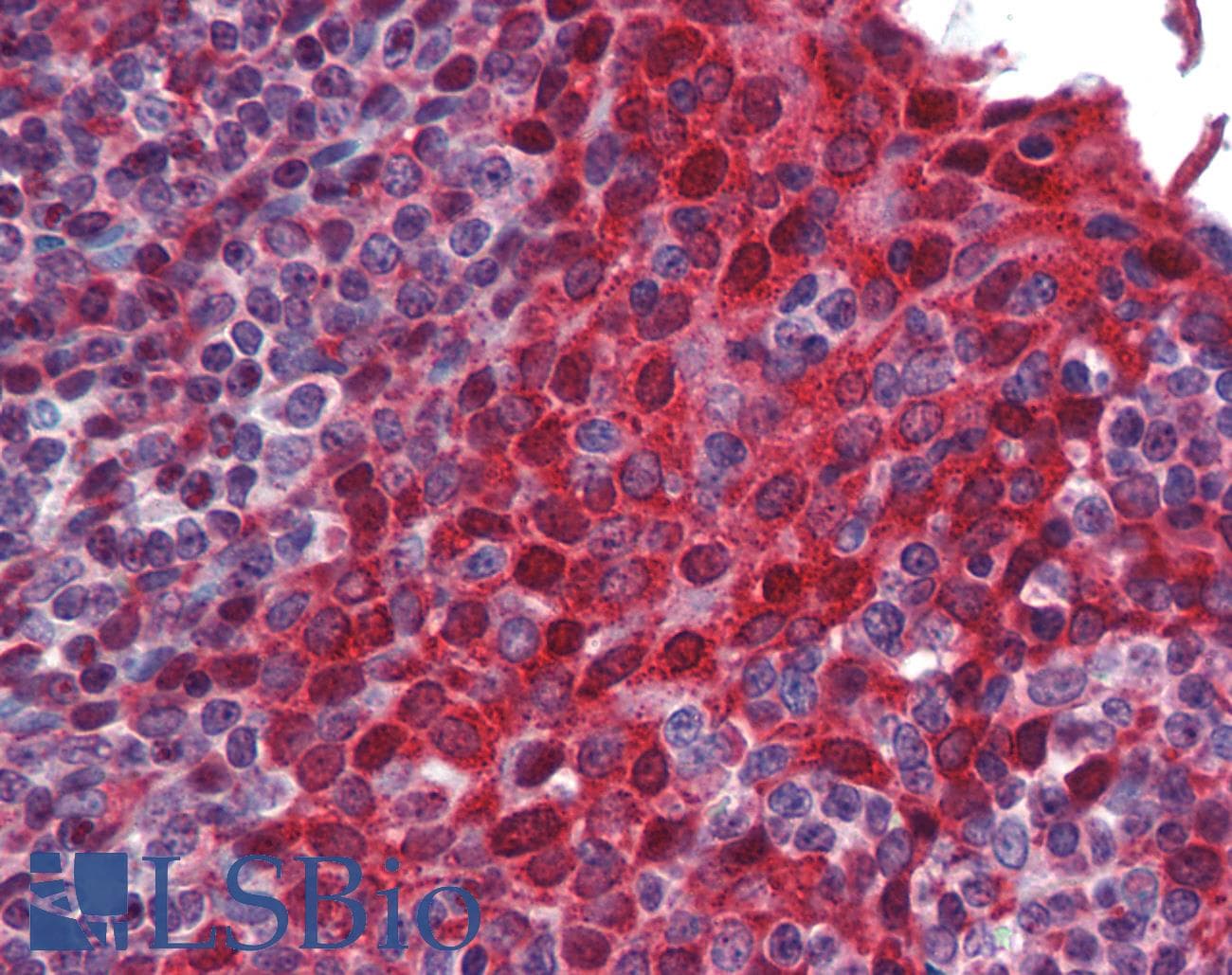SMN1 Antibody (aa45-94, Biotin)