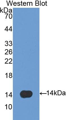 SFTPD / Surfactant Protein D Antibody (aa259-374)