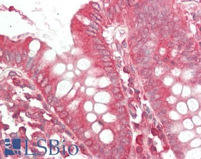 IHC-plus™ ADCYAP1R1 / PAC1 Receptor Antibody (aa21-120)