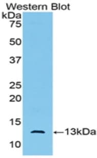 AMH / Anti-Mullerian Hormone Antibody (aa447-553)