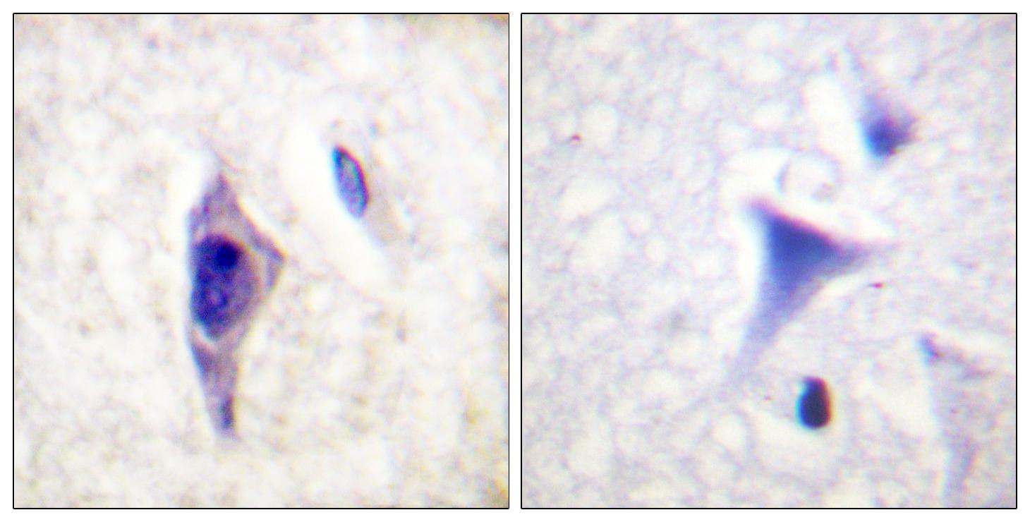 Polyclonal Rabbit anti-Human PIK3R1 / p85 Alpha Antibody (phospho-Tyr607, IHC, WB)