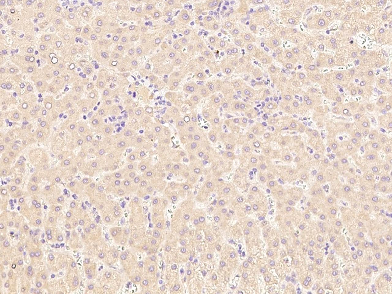 Polyclonal Rabbit anti-Human LCAT Antibody (Preservative Free, IHC)