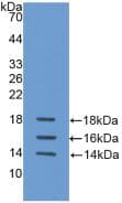 Human IL15 Protein (Recombinant His, N-Terminal)