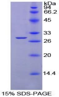 Mouse PTPRS Protein (Recombinant His-T7)