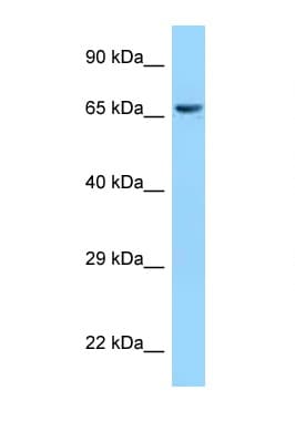 Polyclonal Rabbit anti-Human CLPX Antibody (C-Terminus, WB)