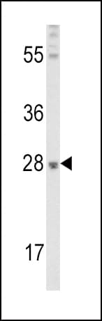 IHC-plus™ FGF10 Antibody (aa136-165)