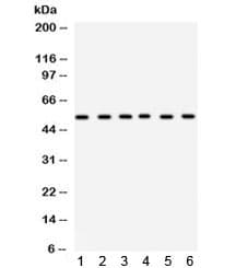 DLD / Diaphorase / E3 Antibody