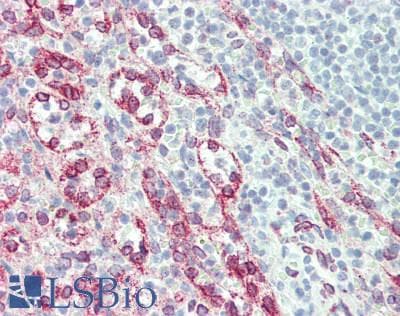 IHC-plus™ Polyclonal Rabbit anti-Human P2RX5 / P2X5 Antibody (aa372-422, IHC, WB)