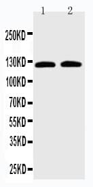 SLC12A6 / KCC3 Antibody (aa1060-1080)
