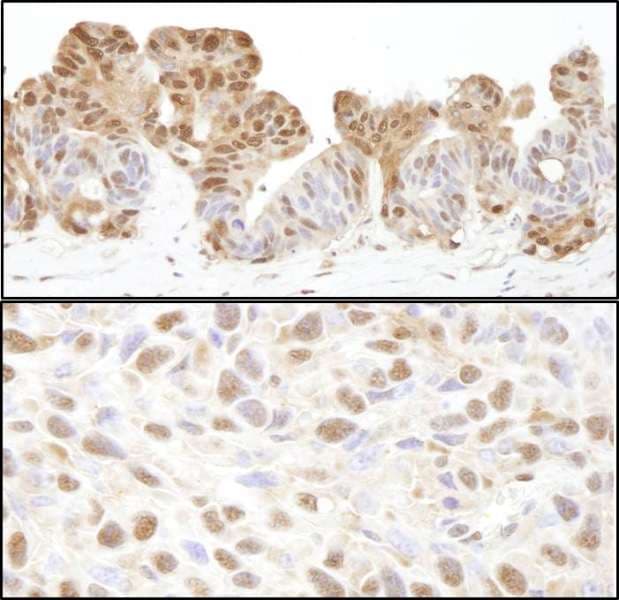 VCP Antibody (aa1-50)