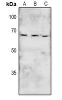 PTK6 / BRK Antibody