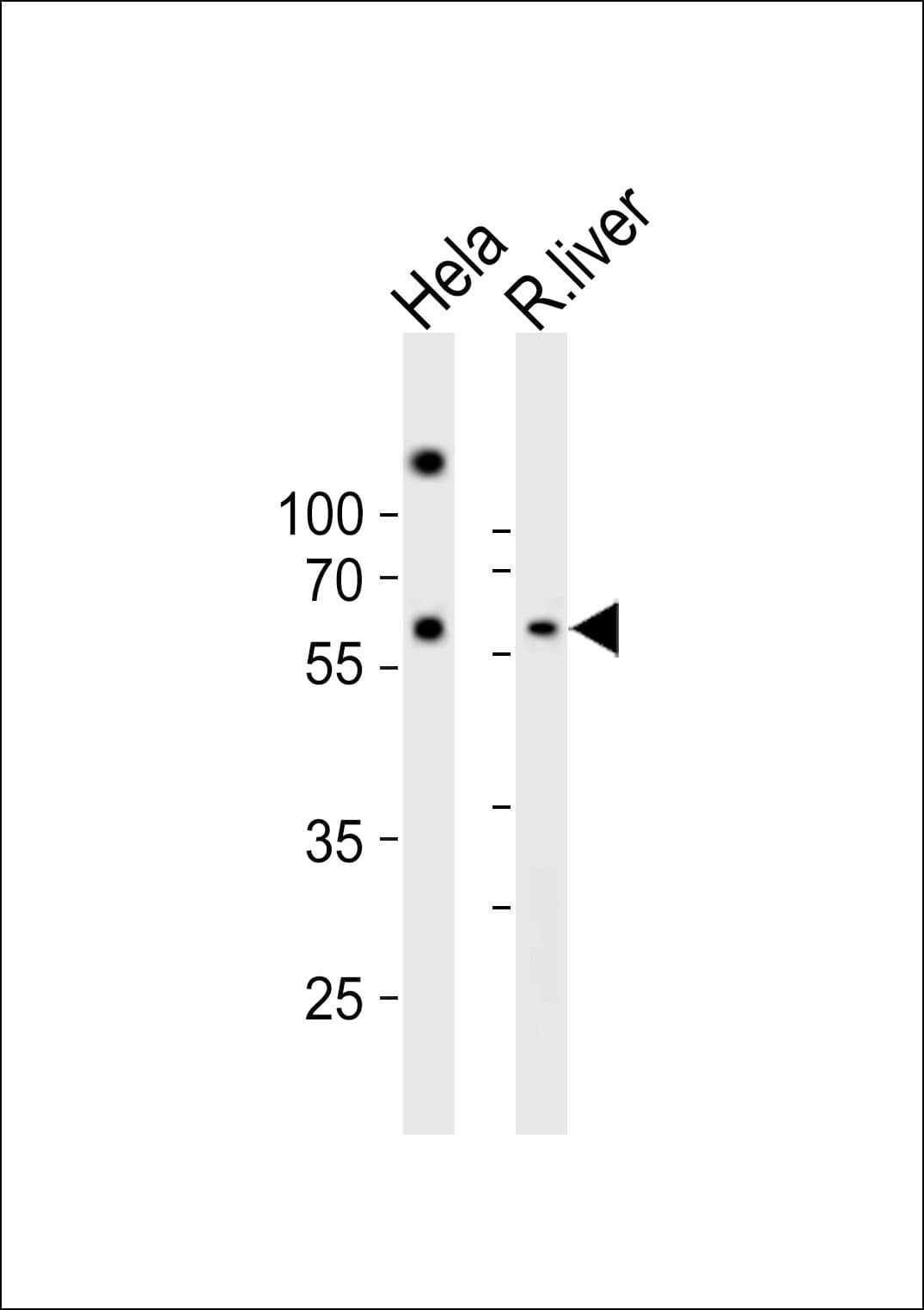 Polyclonal Rabbit anti-Human NFIA / Nuclear Factor 1 Antibody (aa384-418, WB)
