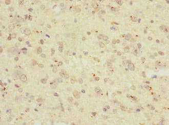 Polyclonal Rabbit anti-Human RGS9 Antibody (IHC)