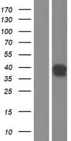 Human SIX3 Protein (Over-Expression Lysate Myc-DDK (Flag))