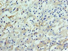 Polyclonal Rabbit anti-Human CSTF2 / CstF-64 Antibody (aa1-180, IHC, WB)