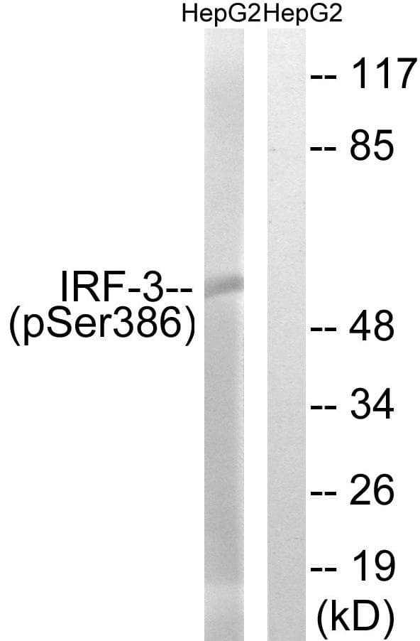 IRF3 Antibody (phospho-Ser386)