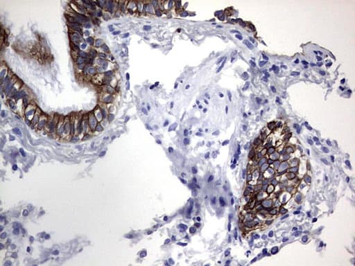 KRT19 / CK19 / Cytokeratin 19 Antibody (aa240-390, clone OTI8D1)