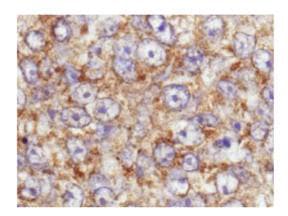 AKT1 + AKT2 + AKT3 Antibody (phospho-Ser473)