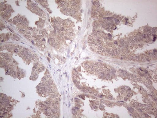 Monoclonal Mouse anti-Human CD275 / B7-H2 / ICOS Ligand Antibody (clone OTI2G10, IHC, WB)