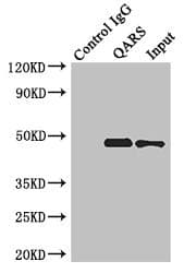 ENTPD5 / CD39L4 Antibody (aa149-428)