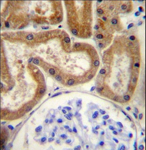 Polyclonal Rabbit anti-Human FGD2 Antibody (aa508-537, IHC, WB)
