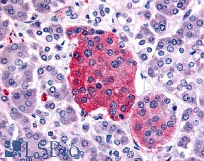 PathPlus™ SSTR2 Antibody (C-Terminus)