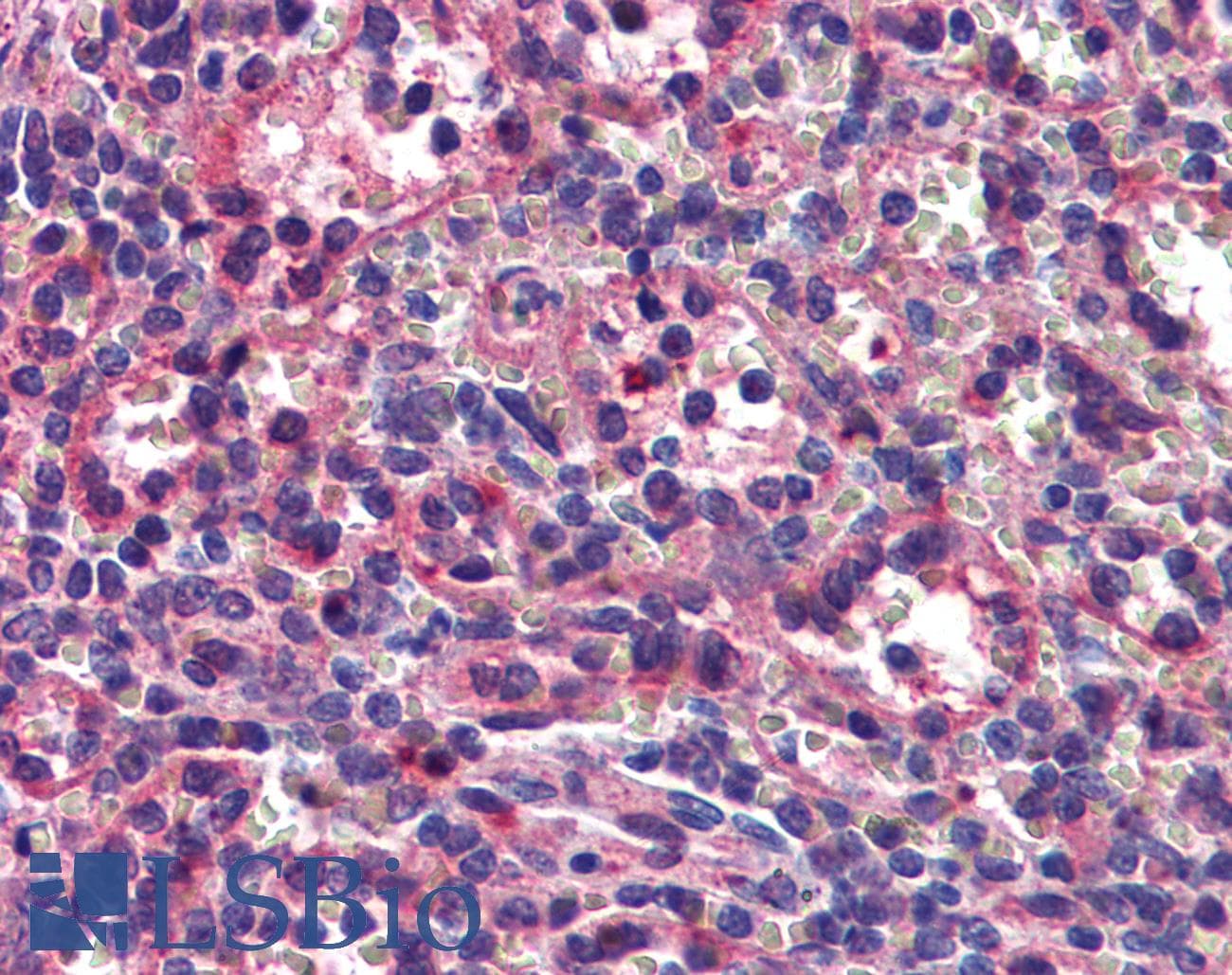 IHC-plus™ Monoclonal Mouse anti-Human SEPT8 / Septin 8 Antibody (clone 1G3-7D1, IHC, WB)