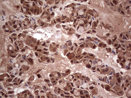 LGALS3 / Galectin 3 Antibody (clone OTI2F1)