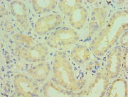 CYP4A11 Antibody (aa1-200)