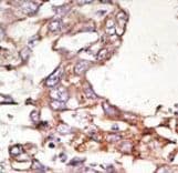 SUMO4 Antibody (Internal)